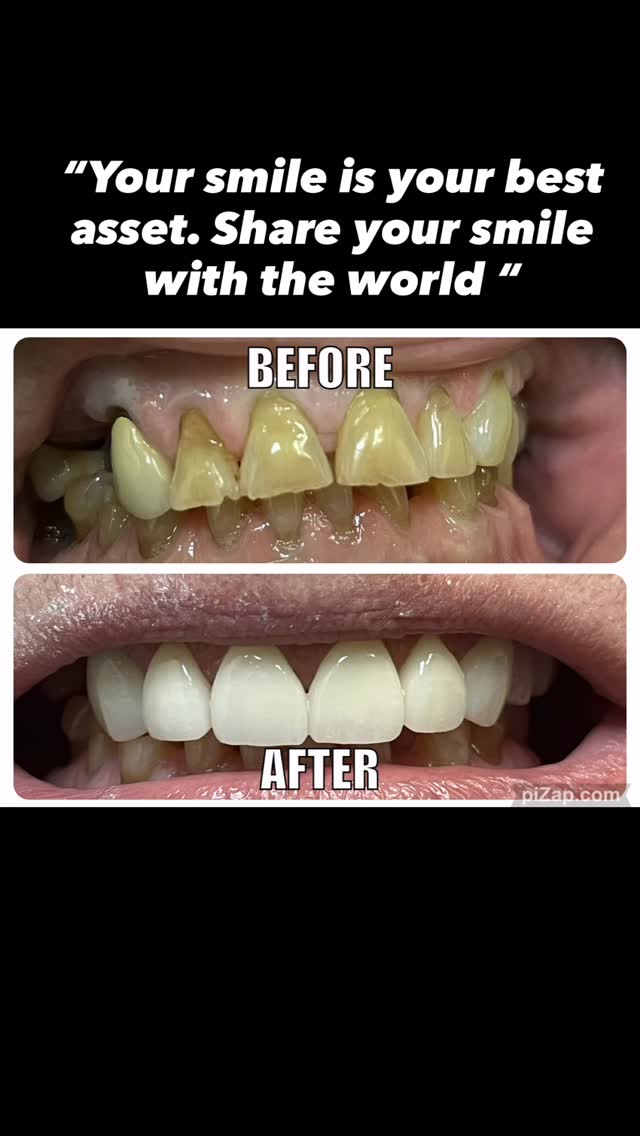 Digital smile design — Natural Smiles Dentistry, Chandler / Sun Lakes AZ