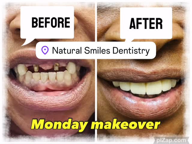 Implant-supported smile makeover — Natural Smiles Dentistry, Chandler / Sun Lakes AZ