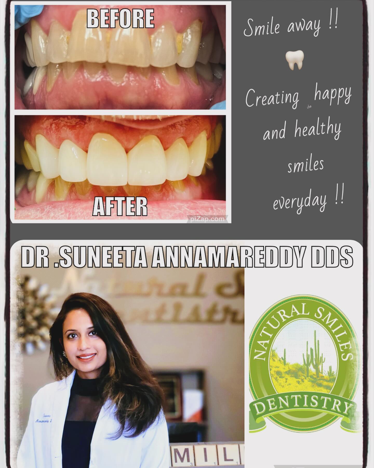 Smile design consult outcome — Natural Smiles Dentistry, Chandler / Sun Lakes AZ