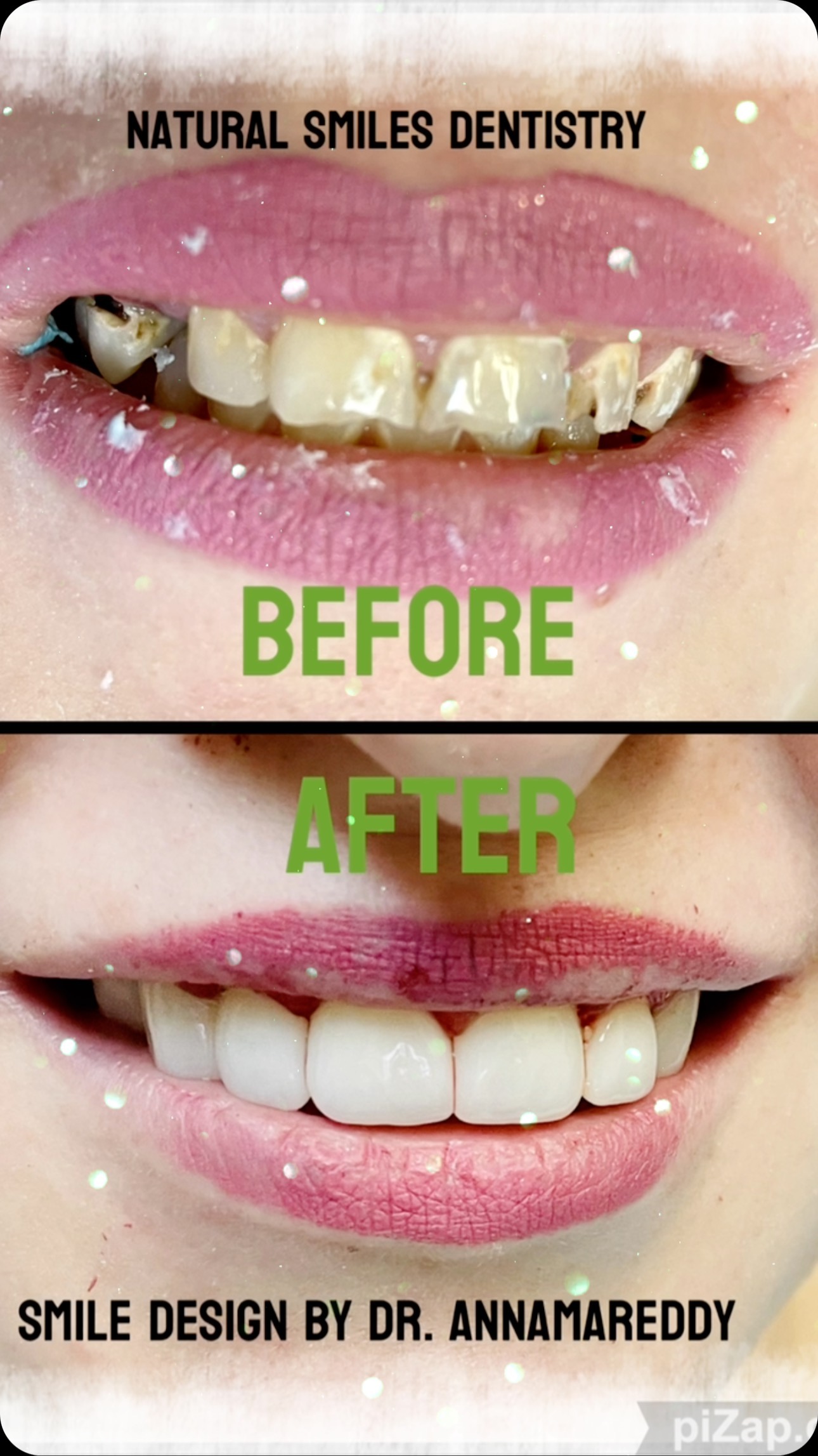 Full smile makeover — Natural Smiles Dentistry, Chandler / Sun Lakes AZ