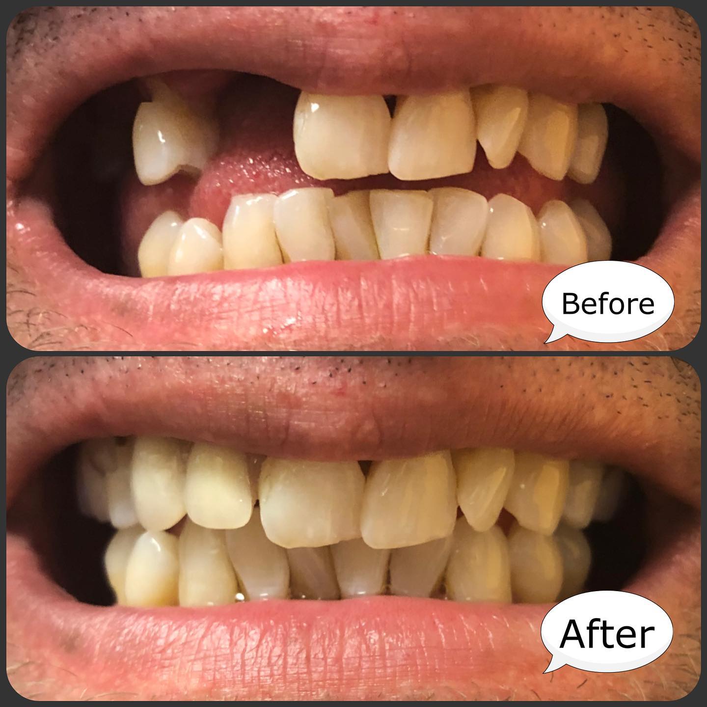 Tooth-loss restoration — Natural Smiles Dentistry, Chandler / Sun Lakes AZ